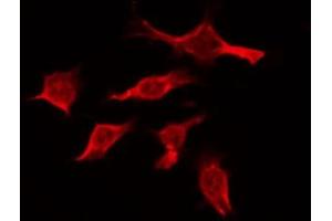ABIN6274395 staining Hela by IF/ICC. (RBM26 antibody  (Internal Region))