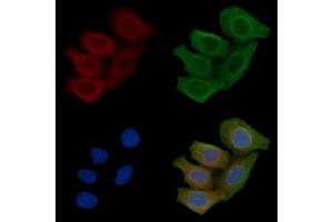 ABIN6257704 and ABIN6275059 staining Hela cells(45 min of heat-shock) by IF/ICC.