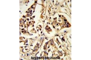 Immunohistochemistry (IHC) image for anti-rho GTPase Activating Protein 18 (ARHGAP18) antibody (ABIN3003783) (ARHGAP18 antibody)