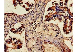Immunohistochemistry of paraffin-embedded human lung tissue using ABIN7143677 at dilution of 1:100 (ALDH3A1 antibody  (AA 210-453))