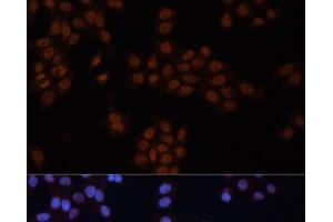 Immunofluorescence analysis of HeLa cells using GTF2I Polyclonal Antibody at dilution of 1:100. (GTF2I antibody)