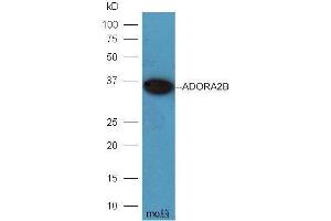 Mouse brain lysates probed with Rabbit Anti-ADORA2B Polyclonal Antibody  at 1:5000 90min in 37˚C. (Adenosine A2b Receptor antibody  (AA 101-200))