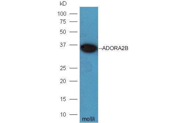 Adenosine A2b Receptor anticorps  (AA 101-200)