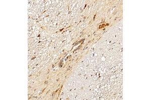 Immunohistochemistry of paraffin embedded rat spinal cord using CNTN6 (ABIN7073576) at dilution of 1:350 (250x lens) (Contactin 6 antibody)