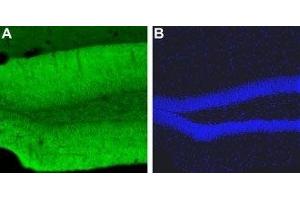 Immunohistochemistry (IHC) image for anti-Calcium Channel, Voltage-Dependent, L Type, alpha 1C Subunit (CACNA1C) (AA 848-865), (Intracellular) antibody (ABIN7043000)