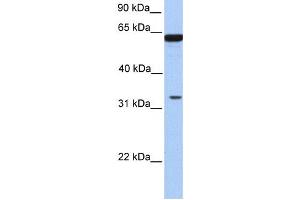 Western Blotting (WB) image for anti-Post-GPI Attachment To Proteins 3 (PGAP3) antibody (ABIN2459368) (PGAP3 antibody)