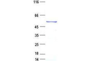 Arrestin Domain Containing 2 (ARRDC2) protein (His tag)