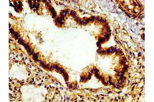 Immunohistochemistry of paraffin-embedded human lung tissue using ABIN7172521 at dilution of 1: 100 (E2F4 antibody  (AA 160-299))