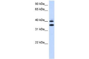 WB Suggested Anti-SLC25A32 Antibody Titration:  0. (SLC25A32 antibody  (Middle Region))