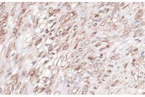 Immunohistochemistry of paraffin-embedded Human uterus using LAMC1 Polyclonal Antibody at dilution of 1:100 (40x lens). (Laminin gamma 1 antibody)