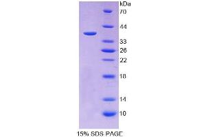 SDS-PAGE (SDS) image for Iduronidase, alpha-L- (IDUA) (AA 28-306) protein (His tag) (ABIN6237569) (IDUA Protein (AA 28-306) (His tag))