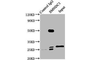 Immunoprecipitating SMNDC1 in Hela whole cell lysate Lane 1: Rabbit control IgG (1 μg) instead of ABIN7171028 in Hela whole cell lysate. (SMNDC1 antibody  (AA 1-238))