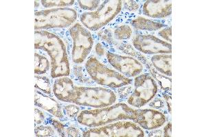 Immunohistochemistry of paraffin-embedded rat testis using NLRP1 Rabbit pAb (ABIN7268935) at dilution of 1:100 (40x lens). (NLRP1 antibody  (AA 1000-1100))