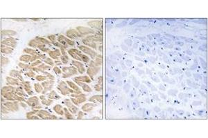 Immunohistochemistry analysis of paraffin-embedded human heart tissue, using MIA Antibody. (MIA antibody  (AA 82-131))