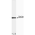 anti-Tumor Protein P53 (TP53) (full length) antibody