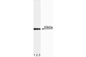 Western blot analysis of p53. (p53 antibody  (full length))