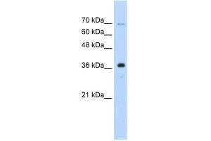 Human HepG2; WB Suggested Anti-ZRANB2 Antibody Titration: 0. (ZNF265 antibody  (Isoform 2, Middle Region))