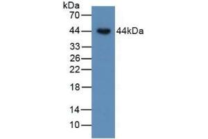 Detection of BMP15 in Human SKOV3 Cells using Polyclonal Antibody to Bone Morphogenetic Protein 15 (BMP15) (BMP15 antibody  (AA 266-388))