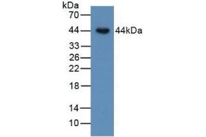 Detection of BMP15 in Human SKOV3 Cells using Polyclonal Antibody to Bone Morphogenetic Protein 15 (BMP15)