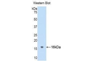 Western Blotting (WB) image for anti-Cystatin SA (CST2) (AA 21-141) antibody (ABIN1176748) (CST2 antibody  (AA 21-141))