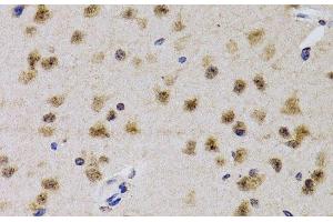 Immunohistochemistry of paraffin-embedded Mouse brain using CDK7 Polyclonal Antibody at dilution of 1:200 (40x lens). (CDK7 antibody)