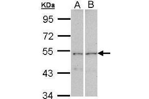 CPEB1 anticorps  (C-Term)