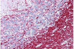 Anti-PLP1 antibody IHC staining of human brain, cerebellum.