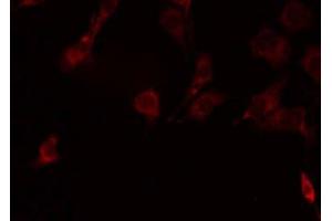 ABIN6278626 staining Hela by IF/ICC. (RELT antibody  (C-Term))