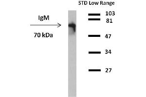 Western blot analysis of detection (reducing conditions) of IgM in human plasma using anti-human IgM peroxidase conjugate. (Mouse anti-Human IgM Antibody)