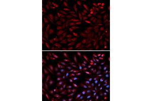 Immunofluorescence analysis of U2OS cell using PSMC2 antibody. (PSMC2 antibody  (AA 1-160))