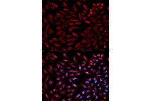 Immunofluorescence analysis of U2OS cell using PSMC2 antibody. (PSMC2 antibody  (AA 1-160))