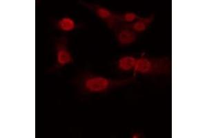 ABIN6266935 staining Hela by IF/ICC. (T-Box 22 antibody  (N-Term))