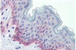 Human Skin (formalin-fixed, paraffin-embedded) stained with PNPT1 antibody ABIN462230 followed by biotinylated goat anti-rabbit IgG secondary antibody ABIN481713, alkaline phosphatase-streptavidin and chromogen. (PNPT1 antibody  (AA 489-538))