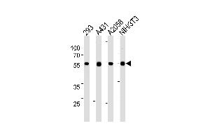 Lane 1: 293 Cell lysates, Lane 2: A431 Cell lysates, Lane 3: A2058 Cell lysates, Lane 4: NIH/3T3 Cell lysates, probed with TPIPb (978CT6. (TPTE2 antibody)