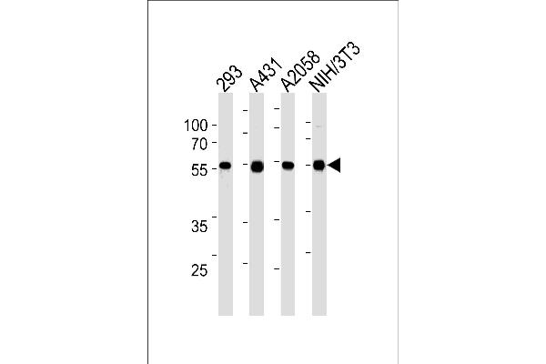 TPTE2 antibody