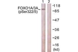Western blot analysis of extracts from NIH-3T3 cells treated with Wortmannin 40nM 24h, using FOXO1A/3A (Phospho-Ser322+Ser325) Antibody. (FOXO1A/3A (AA 291-340), (pSer322) antibody)