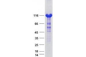 Western Blotting (WB) image for ATP Citrate Lyase (ACLY) (Transcript Variant 1) protein (Myc-DYKDDDDK Tag) (ABIN2715038)
