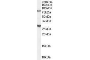 Western Blotting (WB) image for anti-Cysteine-Rich Secretory Protein LCCL Domain Containing 1 (CRISPLD1) (N-Term) antibody (ABIN2156636) (CRISPLD1 antibody  (N-Term))