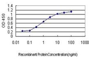 Detection limit for recombinant GST tagged DYRK1A is approximately 0. (DYRK1A antibody  (AA 674-763))