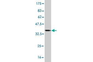 Western Blot detection against Immunogen (36. (MID1 antibody  (AA 441-540))