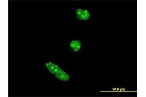 Immunofluorescence of monoclonal antibody to TWIST1 on HeLa cell.