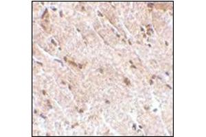Immunohistochemistry of MAPKAP1 in human skeletal muscle tissue with this product at 5 μg/ml. (Transportin 1 antibody  (Center))