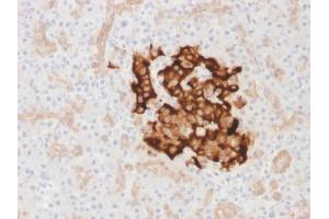 Formalin-fixed, paraffin-embedded human Pancreas stained with Insulin Rabbit Recombinant Monoclonal Antibody (IRDN/1980R). (Recombinant Insulin antibody)