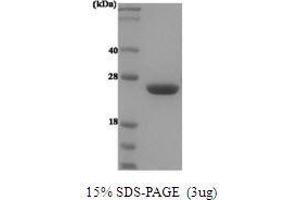 Figure annotation denotes ug of protein loaded and % gel used. (Prolactin (PRL) (AA 29-227) Peptide)