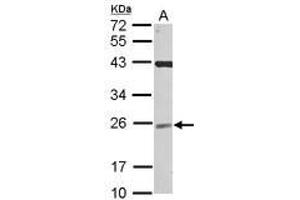 Image no. 1 for anti-Ubiquitin-Conjugating Enzyme E2F (UBE2F) (AA 1-185) antibody (ABIN1501629) (UBE2F antibody  (AA 1-185))