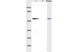 L1 rat brain lysates L2 rat kidney lysates probed with Anti CSIG Polyclonal Antibody, Unconjugated (ABIN728248) at 1:200 overnight at 4 °C. (RSL1D1 antibody  (AA 151-250))
