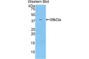 Detection of Recombinant KRT71, Mouse using Polyclonal Antibody to Keratin 71 (KRT71) (Keratin 71 antibody  (AA 132-440))