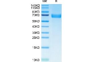 SDS-PAGE (SDS) image for AXL Receptor tyrosine Kinase (AXL) (AA 33-442) protein (His tag) (ABIN7273881)
