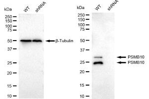 Western blotting analysis using PSMB10 antibody (ABIN7799951).
