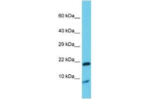 Host: Rabbit Target Name: Grem1 Sample Type: Rat Testis lysates Antibody Dilution: 1. (GREM1 antibody  (Middle Region))